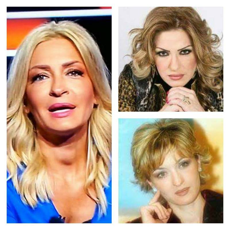 صور مذيعات وإعلاميات العالم العربي قبل وبعد التجميل..الصورة 7 حقاً صادمة!